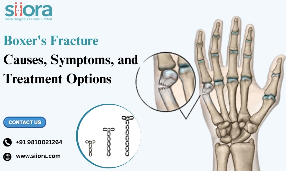 Boxer’s Fracture: Causes, Symptoms, and Treatment&nbsp;Options